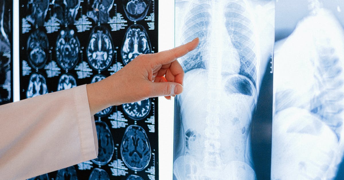 woman-pointing-at-x-ray-picture